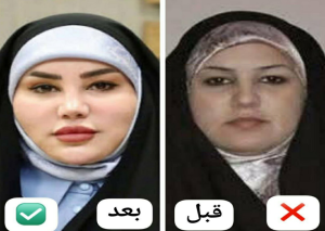 ست امطار المياحي قبل وبعد